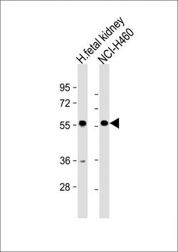 Invitrogen XKRX Polyclonal Antibody 400 &mu;L; Unconjugated:Antibodies,