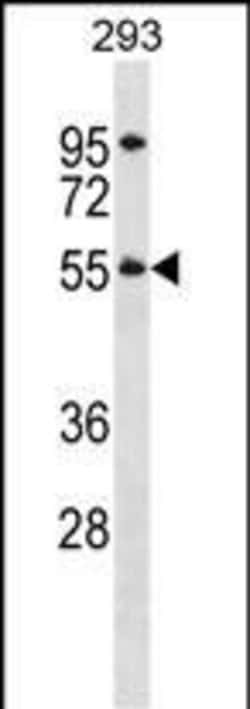 Invitrogen TTC8 Polyclonal Antibody 400 &mu;L; Unconjugated:Antibodies,