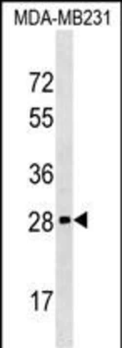Invitrogen H1FOO Polyclonal Antibody 400 μL; Unconjugated:Antibodies,