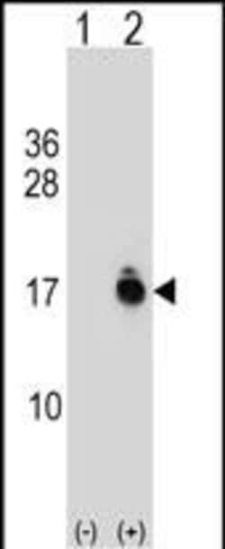 Invitrogen ACYP1 Polyclonal Antibody 400 &mu;L | Buy Online | Invitrogen&trade; | Fisher Scientific