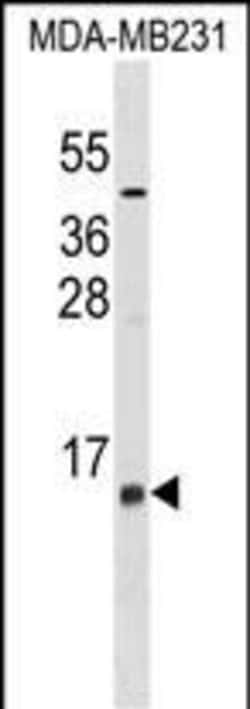 Invitrogen LST1 Polyclonal Antibody 400 &mu;L | Buy Online | Invitrogen&trade; | Fisher Scientific