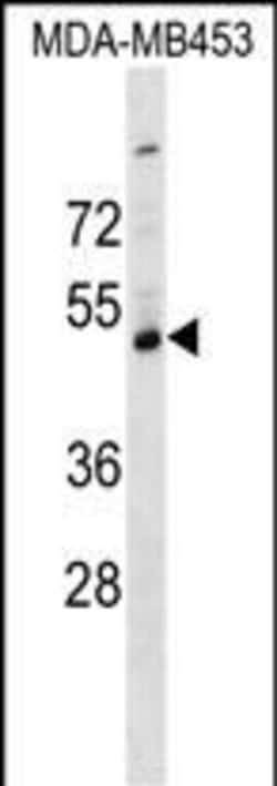 Invitrogen SERPINI2 Polyclonal Antibody 400 &mu;L; Unconjugated:Antibodies,
