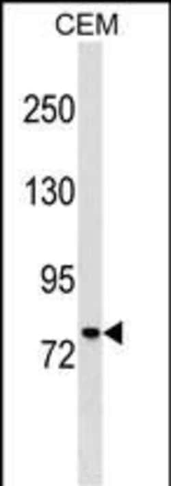 Invitrogen MUM1 Polyclonal Antibody 400 &mu;L; Unconjugated:Antibodies,