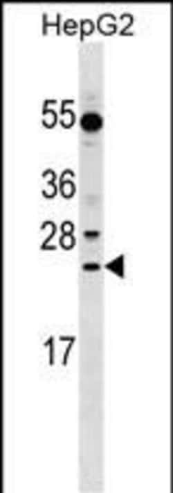 Invitrogen LRRC29 Polyclonal Antibody 400 &mu;L; Unconjugated:Antibodies,