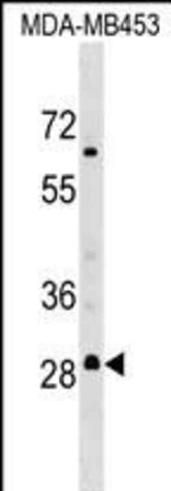 Invitrogen MARCH3 Polyclonal Antibody 400 &mu;L; Unconjugated:Antibodies,