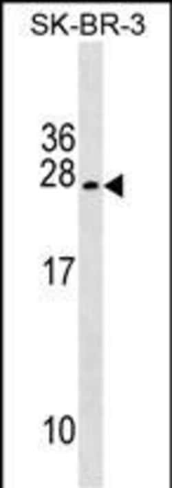 Invitrogen TUSC5 Polyclonal Antibody 400 &mu;L; Unconjugated:Antibodies,