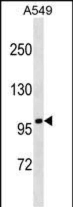 Invitrogen FANCB Polyclonal Antibody 400 &mu;L; Unconjugated:Antibodies,