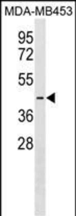 Invitrogen Pejvakin Polyclonal Antibody 400 &mu;L; Unconjugated:Antibodies,