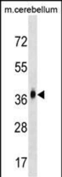 Invitrogen MMD2 Polyclonal Antibody 400 &mu;L; Unconjugated:Antibodies,
