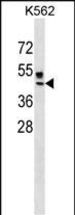 Invitrogen ZNRF4 Polyclonal Antibody 400 &mu;L; Unconjugated:Antibodies,