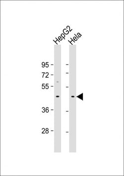 Invitrogen GIPC3 Polyclonal Antibody 400 &mu;L; Unconjugated:Antibodies,