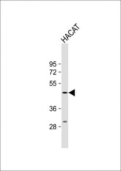 Invitrogen PGRP-1b Polyclonal Antibody 400 &mu;L; Unconjugated:Antibodies,