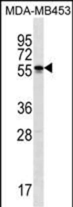 SOHLH2 Polyclonal Antibody 400 &mu;L | Buy Online | Thermo Scientific | Fisher Scientific