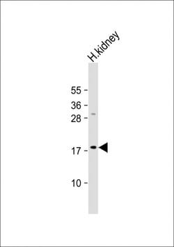 Invitrogen LYZL1 Polyclonal Antibody 400 &mu;L; Unconjugated:Antibodies,