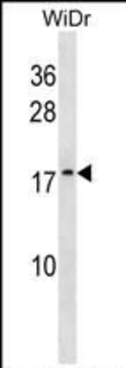Invitrogen ATP5L2 Polyclonal Antibody 400 &mu;L; Unconjugated:Antibodies,
