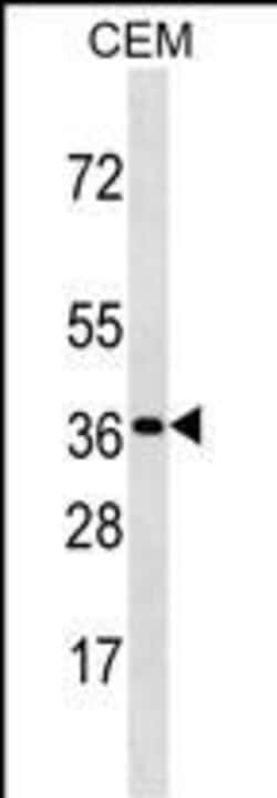 Invitrogen OR3A3 Polyclonal Antibody 400 &mu;L | Buy Online | Invitrogen&trade; | Fisher Scientific