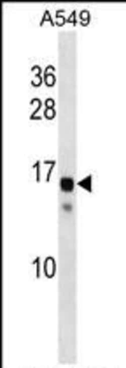 Invitrogen KRAB related Polyclonal Antibody 400 &mu;L; Unconjugated:Antibodies,