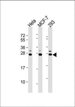 Invitrogen KDEL Polyclonal Antibody 400 &mu;L | Buy Online | Invitrogen&trade; | Fisher Scientific