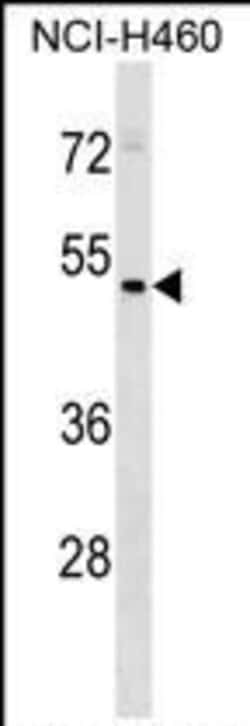Invitrogen&trade;&nbsp;HEPACAM2 Polyclonal Antibody