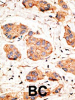Invitrogen Connexin 43 Polyclonal Antibody 400 &mu;L | Buy Online | Invitrogen&trade; | Fisher Scientific
