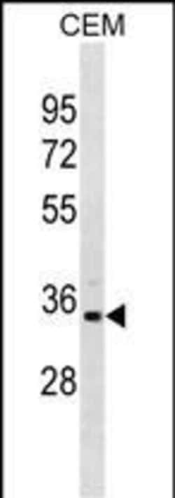 Invitrogen PRPS1L1 Polyclonal Antibody 400 &mu;L; Unconjugated:Antibodies,