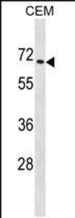Invitrogen ZNF93 Polyclonal Antibody 400 &mu;L; Unconjugated:Antibodies,