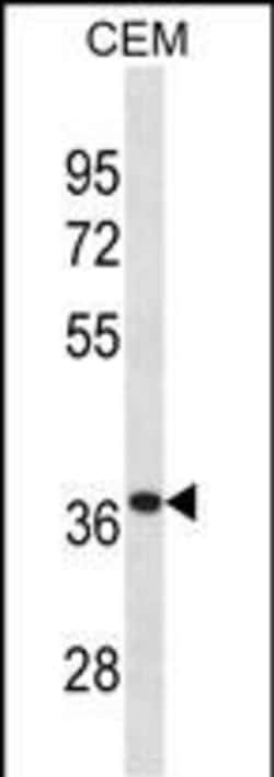 alpha TTP Polyclonal Antibody:Antibodies, Polyclonal