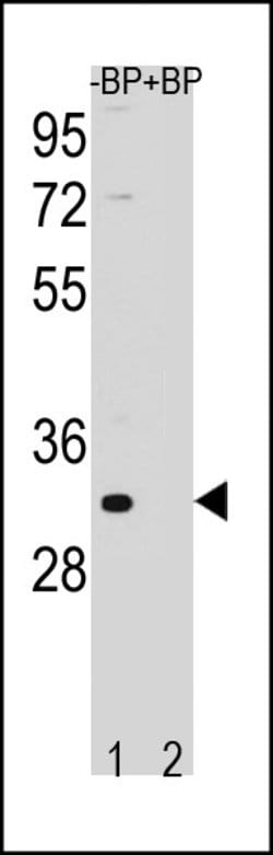 Invitrogen FAM26F Polyclonal Antibody 400 &mu;L | Buy Online | Invitrogen&trade; | Fisher Scientific