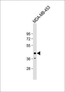 Invitrogen LMAN2L Polyclonal Antibody 400 &mu;L; Unconjugated:Antibodies,