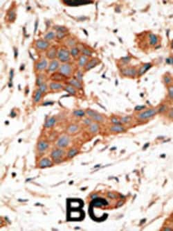 Invitrogen Connexin 46 Polyclonal Antibody 400 &mu;L; Unconjugated:Antibodies,