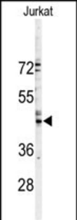 Invitrogen Connexin 46 Polyclonal Antibody 400 &mu;L; Unconjugated:Antibodies,