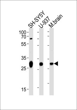 Invitrogen ANP32E Polyclonal Antibody 400 &mu;L; Unconjugated:Antibodies,