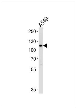 Invitrogen BICC1 Polyclonal Antibody 400 &mu;L | Buy Online | Invitrogen&trade; | Fisher Scientific