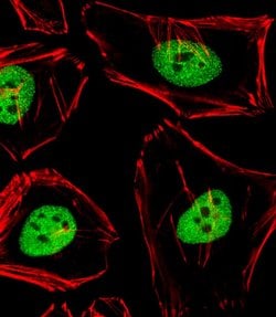Invitrogen ANAPC2 Polyclonal Antibody 400 &mu;L; Unconjugated:Antibodies,