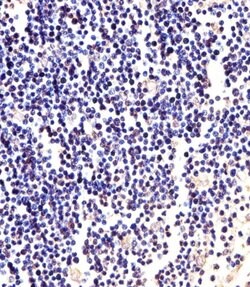 Invitrogen ANAPC2 Polyclonal Antibody 400 &mu;L; Unconjugated:Antibodies,