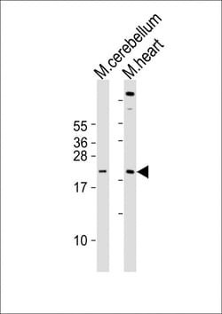 Invitrogen SCXA Polyclonal Antibody 400 &mu;L | Buy Online | Invitrogen&trade; | Fisher Scientific