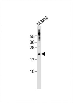 Invitrogen SCXA Polyclonal Antibody 400 &mu;L | Buy Online | Invitrogen&trade; | Fisher Scientific