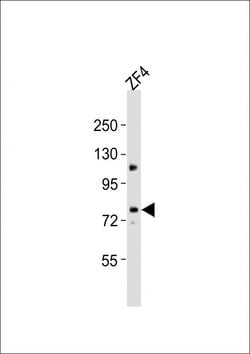 Invitrogen MTM1 Polyclonal Antibody 400 &mu;L | Buy Online | Invitrogen&trade; | Fisher Scientific