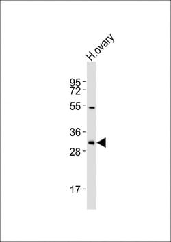 Invitrogen NBPF12 Polyclonal Antibody 400 &mu;L; Unconjugated:Antibodies,