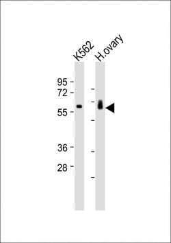 Invitrogen C17orf80 Polyclonal Antibody 400 &mu;L; Unconjugated:Antibodies,