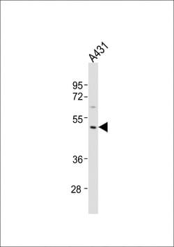 Invitrogen MMP23 Polyclonal Antibody 400 &mu;L; Unconjugated:Antibodies,