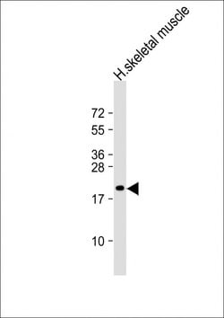 Invitrogen NACA2 Polyclonal Antibody 200 &mu;L | Buy Online | Invitrogen&trade; | Fisher Scientific