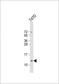 Invitrogen Mammaglobin A Polyclonal Antibody 200 &mu;L | Buy Online | Invitrogen&trade; | Fisher Scientific