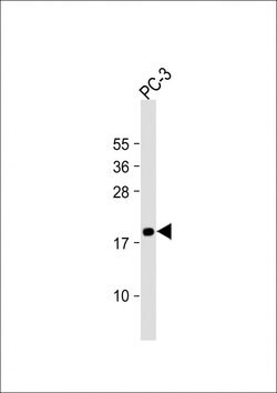 Invitrogen MEAF6 Polyclonal Antibody 200 μL; Unconjugated:Antibodies,