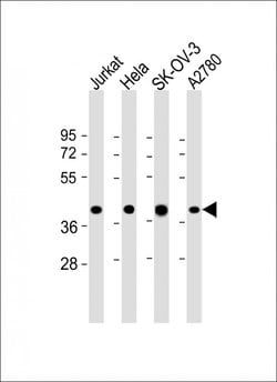 GBGT1 Polyclonal Antibody:Antibodies, Polyclonal