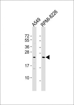 Invitrogen NT5M Polyclonal Antibody 200 &mu;L; Unconjugated:Antibodies,