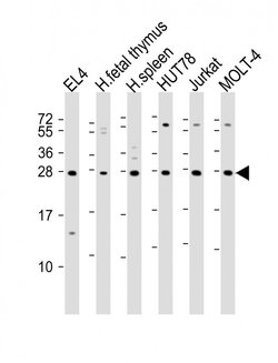 Invitrogen TIGIT Polyclonal Antibody 200 &mu;L; Unconjugated:Antibodies,