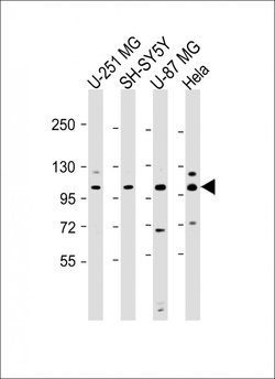 Invitrogen SH3PXD2B Polyclonal Antibody 200 &mu;L; Unconjugated:Antibodies,