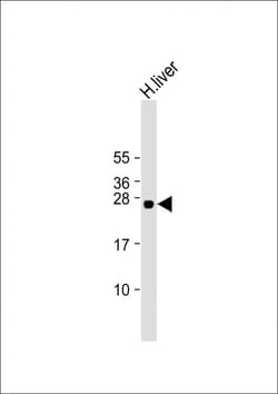 Invitrogen GSTA5 Polyclonal Antibody 200 &mu;L | Buy Online | Invitrogen&trade; | Fisher Scientific