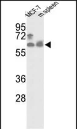 Invitrogen PANK1 Polyclonal Antibody 400 &mu;L | Buy Online | Invitrogen&trade; | Fisher Scientific
